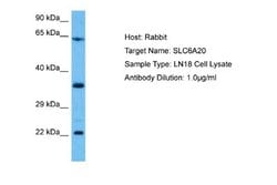 SLC6A20 Rabbit anti-Human, Polyclonal, Novus Biologicals 0.1ml; Unconjugated:Antibodies,